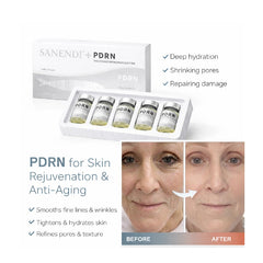 Sanendi Aesthetic Pdrn Skincare for Skin Brightening And Repair. 7MLX5