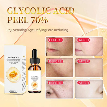 SANLIVNA Essence Skin Care Face Improvement Exfoliation Pigmentation Scars