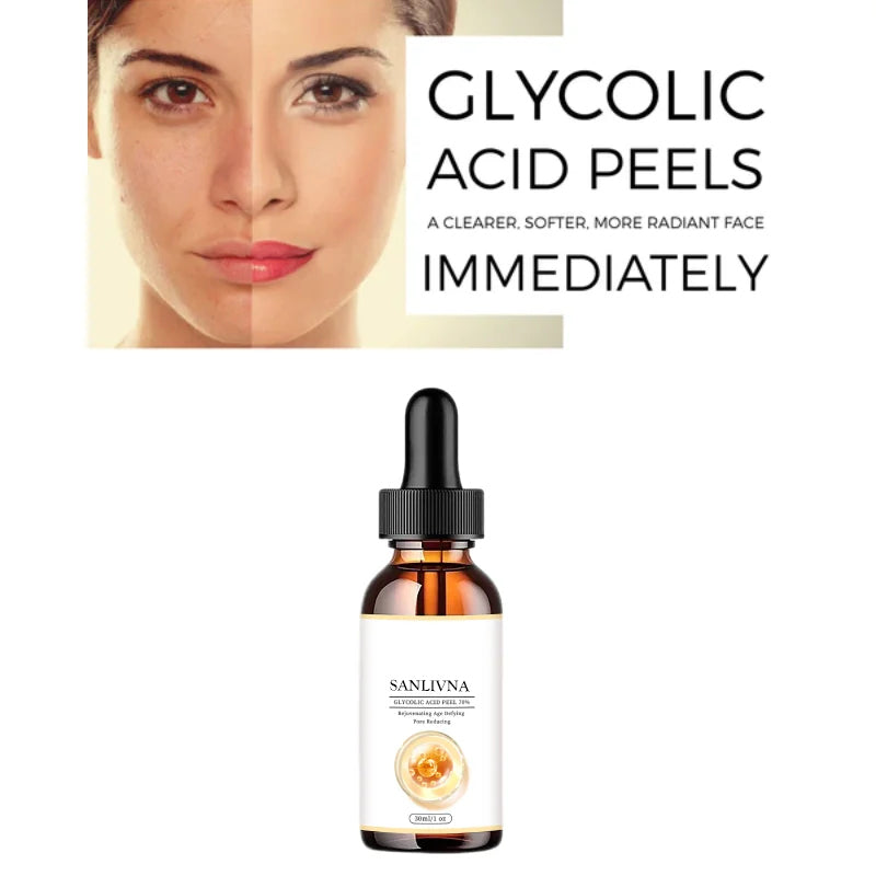 SANLIVNA Essence Skin Care Face Improvement Exfoliation Pigmentation Scars