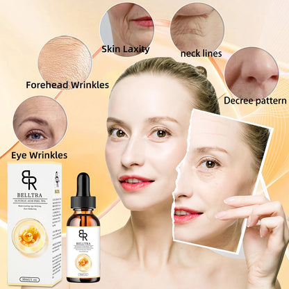 GLYCOLIC ACID PEEL 70% 30ML