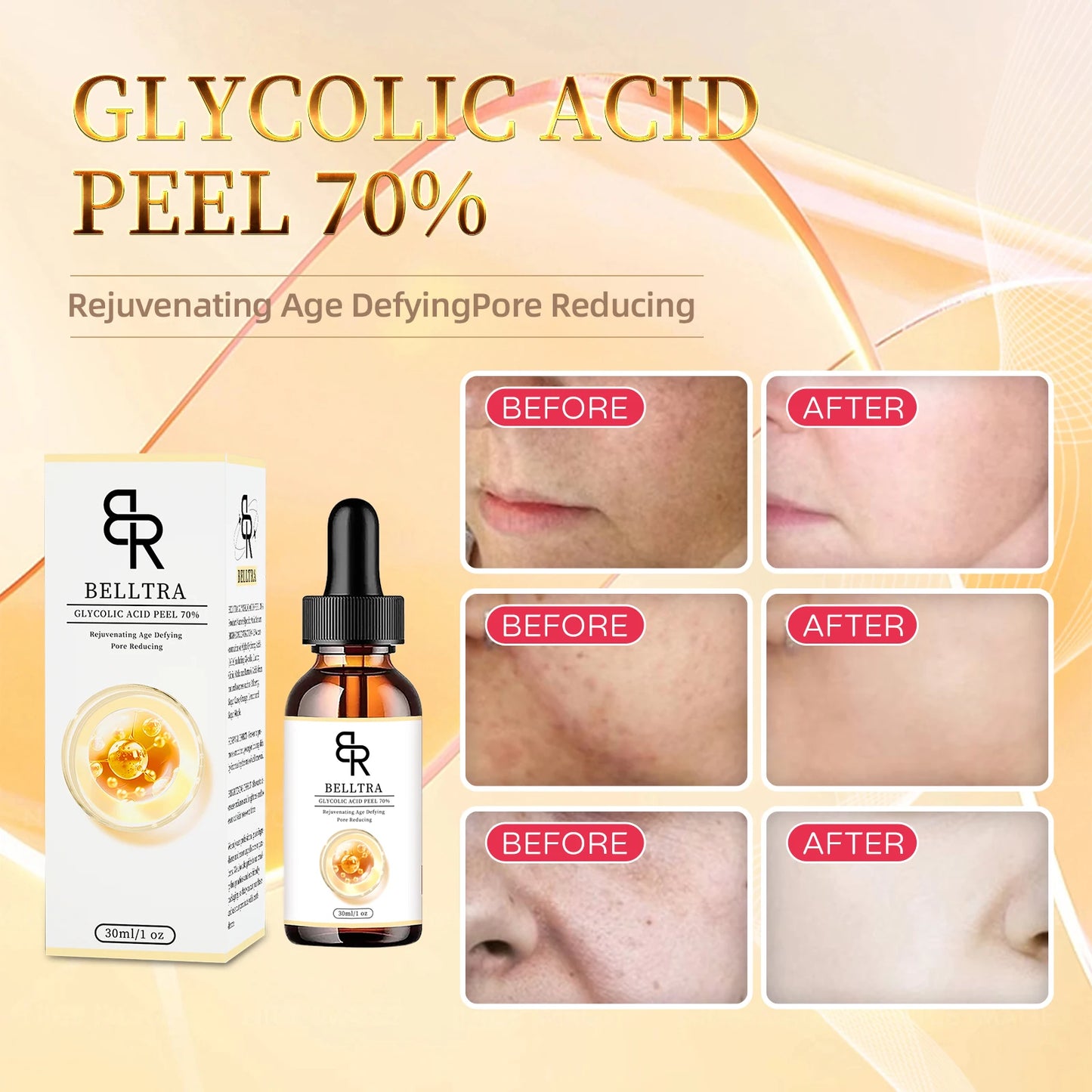 GLYCOLIC ACID PEEL 70% 30ML