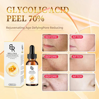 GLYCOLIC ACID PEEL 70% 30ML