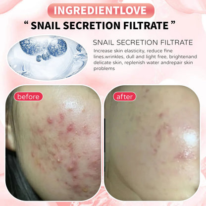 TCA AID SKIN PEEL 20% 30ML