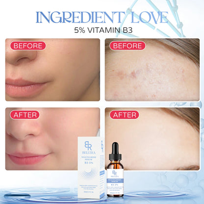 NIACINAMIDE SERUM 30ML