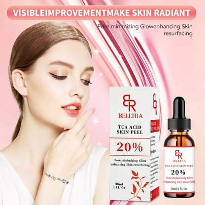 TCA AID SKIN PEEL 20% 30ML